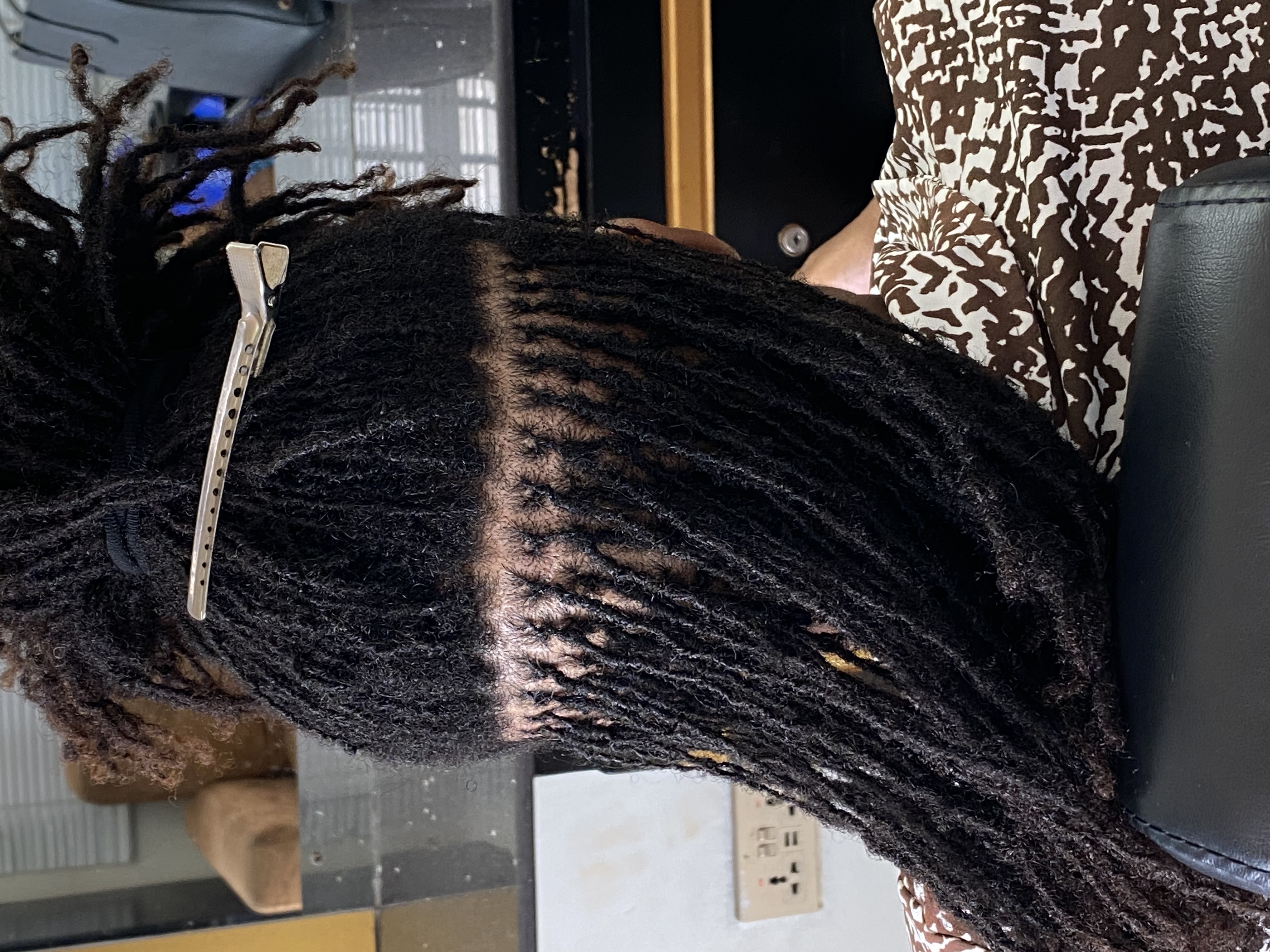 Microlocks Maintenance: It’s More Than Retightening the Roots