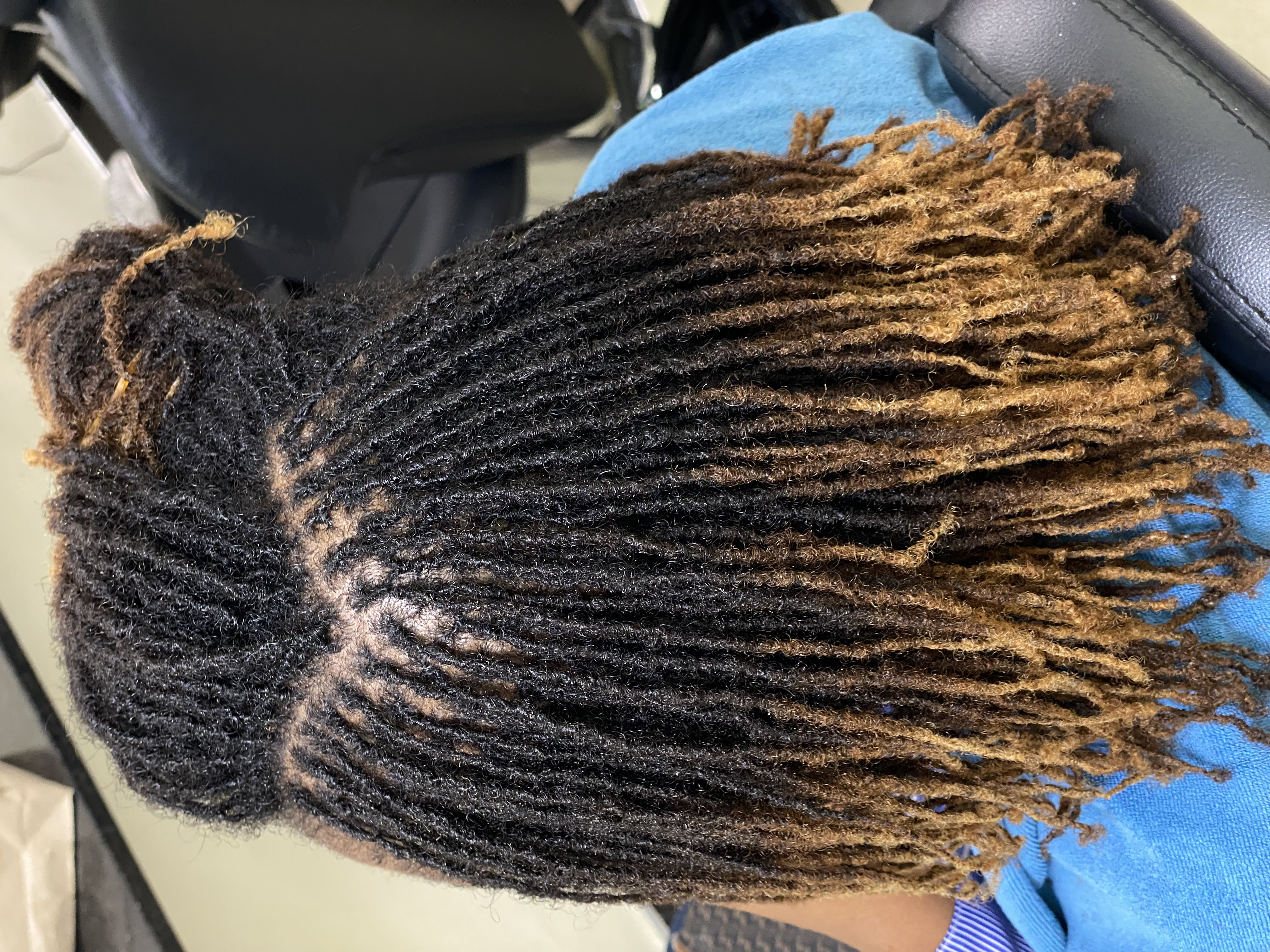 What Your Scalp Is Telling You During Your Microlocks Journey